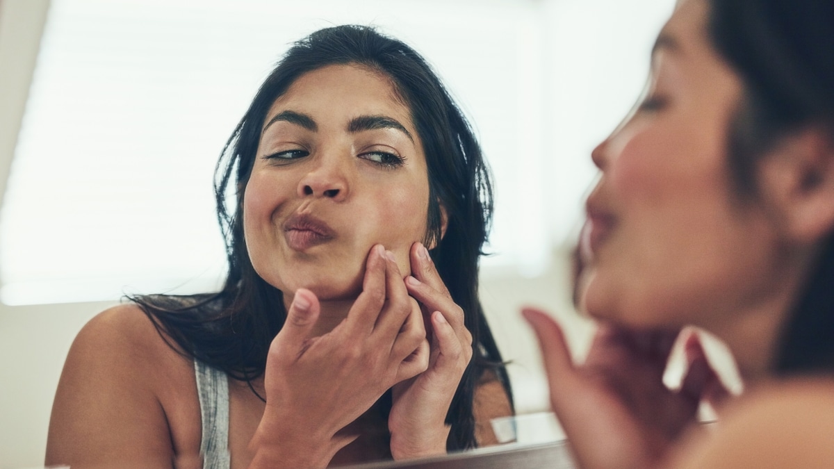 Boutons d'acné : les produits à éviter pour votre peau
